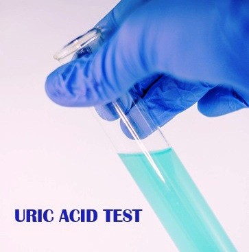 URIC